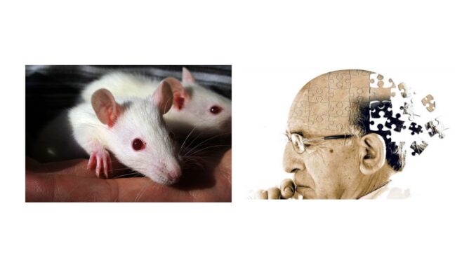 alzheimer